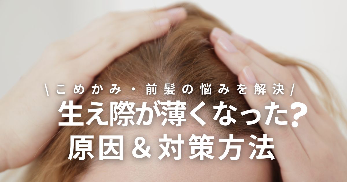 女性の生え際が薄くなる原因と対策|こめかみ・前髪の薄毛が気になりはじめたら