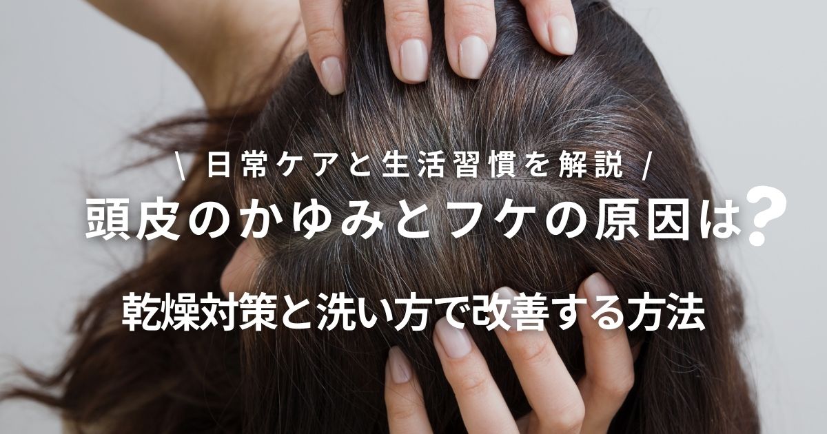 頭皮のかゆみとフケの原因は?乾燥対策と正しい洗い方で改善する方法