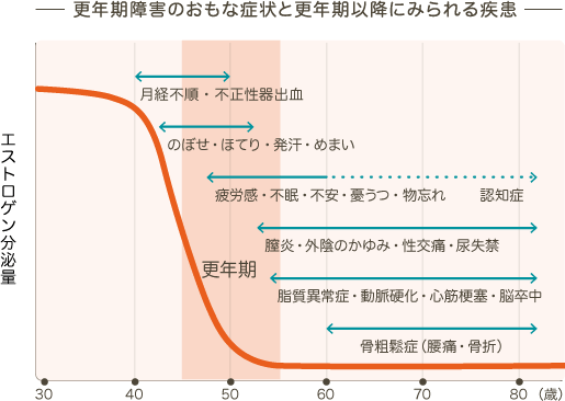 更年期 障害 症状